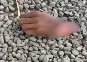 Ladrão tem mão decepada com facão em assalto; veja o vídeo