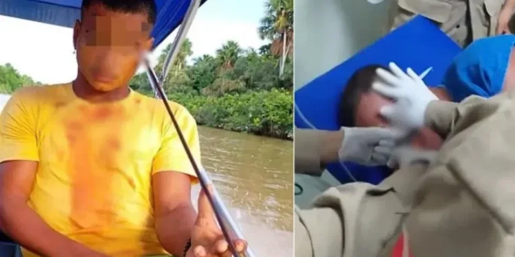 Jovem é atingido por arpão que ele disparou acidentalmente