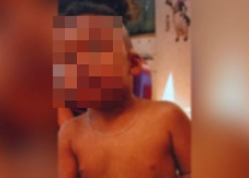 Criança de 6 anos morre após pote com álcool explodir