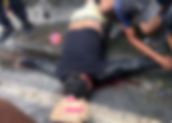 Grave acidente deixa motociclista em estado grave e com fratura exposta; veja o vídeo