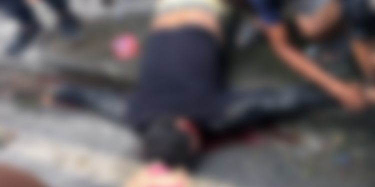 Grave acidente deixa motociclista em estado grave e com fratura exposta; veja o vídeo