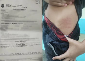 Adolescente autista agredido por motorista relata: “Ele me chamou de bandido da boca”