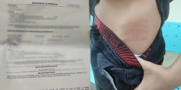 Adolescente autista agredido por motorista relata: “Ele me chamou de bandido da boca”