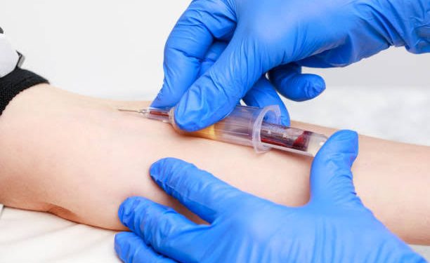 Professor de química é demitido após usar agulha compartilhada por 43 alunos em aula de ciências