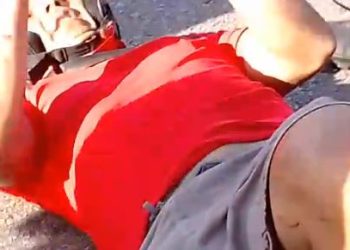 Homem é atropelado e tem a perna dilacerada em Manaus