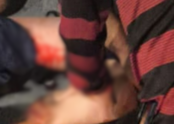 Menino de 10 anos é atropelado enquanto empinava pipa