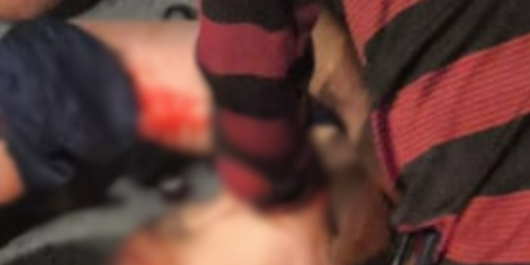 Menino de 10 anos é atropelado enquanto empinava pipa