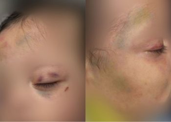 Homem é preso em flagrante por agredir gravemente os próprios filhos de 5 meses e 1 ano