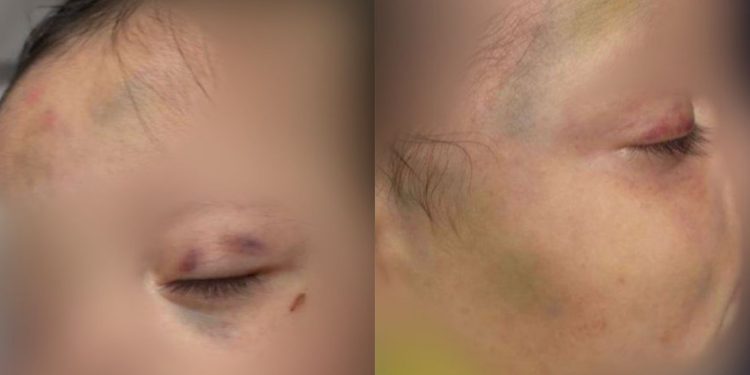 Homem é preso em flagrante por agredir gravemente os próprios filhos de 5 meses e 1 ano