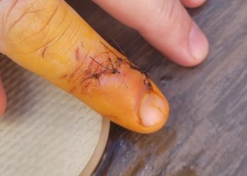 Lagoa artificial de Bonito é interditada após mordidas de peixes em visitantes