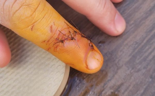 Lagoa artificial de Bonito é interditada após mordidas de peixes em visitantes