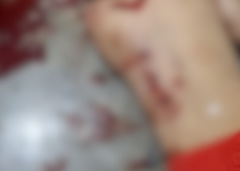 Jovem é assassinado a tiros dentro de apartamento do Prosamim