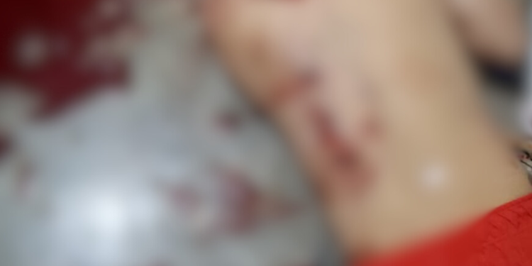 Jovem é assassinado a tiros dentro de apartamento do Prosamim