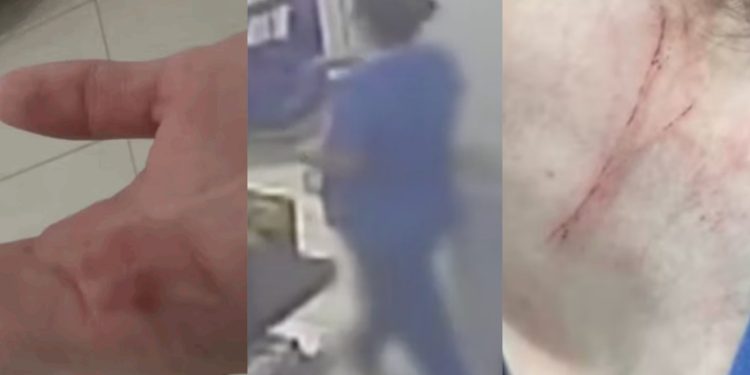 Enfermeira e técnica de enfermagem são agredidas e enforcadas por paciente em UPA; veja o vídeo 