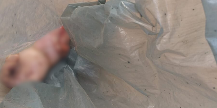 Corpo de bebê é encontrado mutilado em lixeira