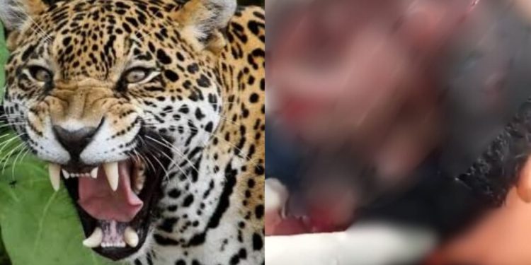 Indígena sobrevive a ataque de onça e tem couro cabeludo dilacerado