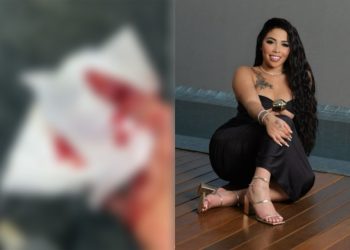 Influenciadora digital é atacada a faca por vizinha em condomínio