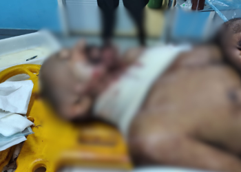 Idoso reage a assalto e é golpeado no pescoço com terçado