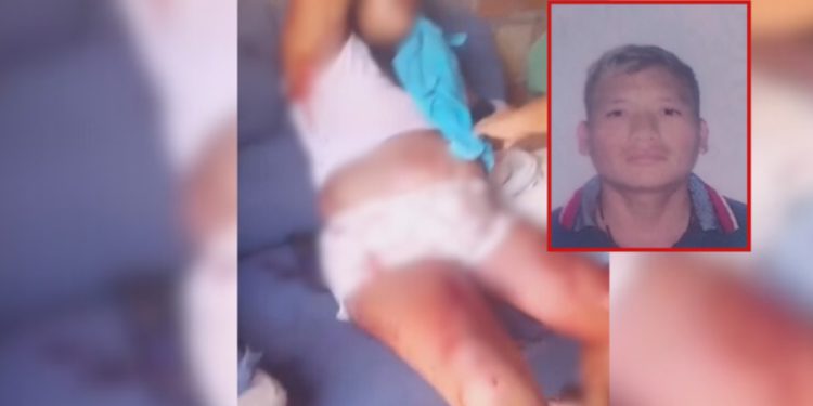 Marido desfere facadas em esposa grávida e foge em Manaus