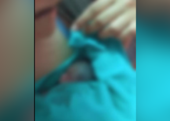 Médica explica caso de bebê dado como morto que ‘voltou a vida’; família é do AM