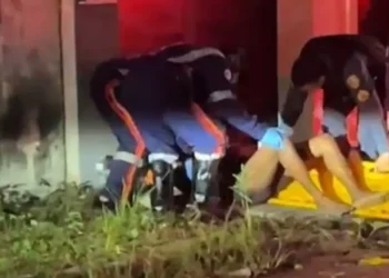 Mulher é brutalmente espancada e sofre fraturas nas pernas