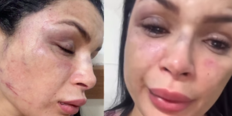 Polícia prende suspeito de agredir passageira durante corrida de app